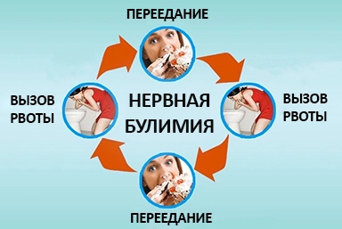 Лечение булимии в Ашукино